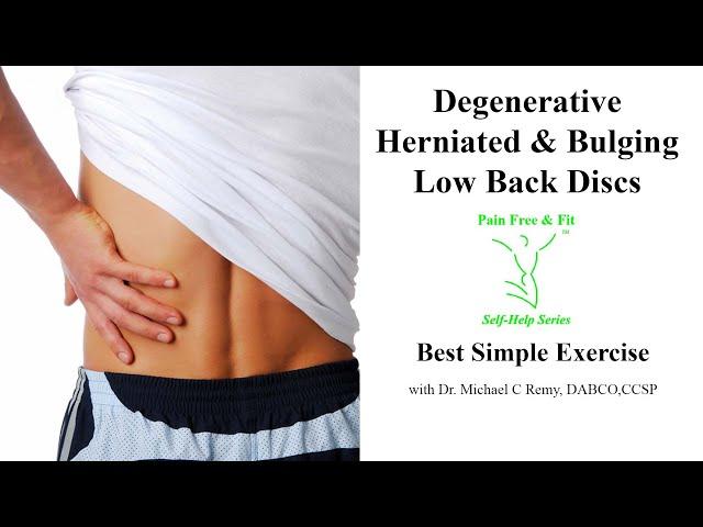 Degenerative Disc Disease, Herniated & Bulging Discs L1, L2 L3 L4 L5 S1- Best Simple Exercise