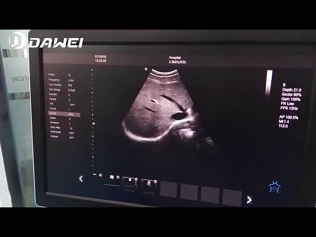 DW-T5 color doppler ultrasound scanner machine price with low cost