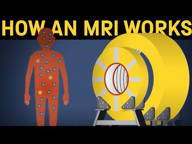 How does an MRI machine work?