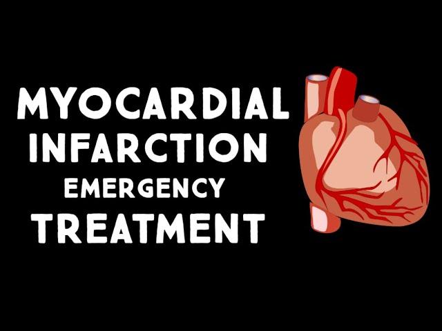 Myocardial Infarction (MI,Heart Attack) Treatment in Emergency | Step wise  STEMI Management USMLE