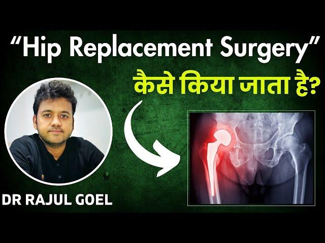 Hip Replacement Surgery | Dr Rajul Goel | Hip Replacement in Kurukshetra | THR Kurukshetra