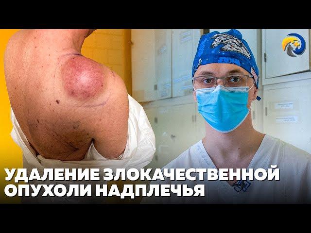 Удаление злокачественной опухоли надплечья | Операции