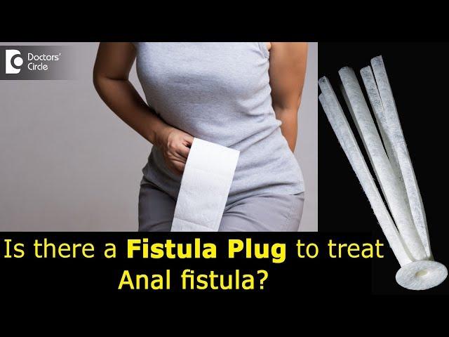 What is a Fistula Plug? Treating anal fistula with anal plug - Dr. Rajasekhar M R | Doctors' Circle