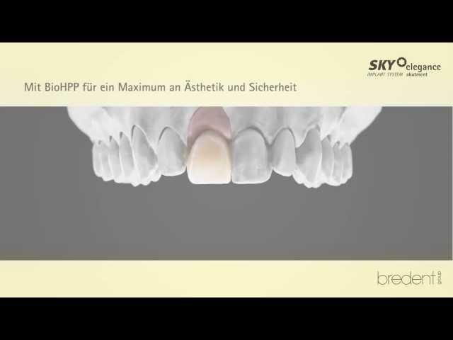 BioHPP SKY elegance - individuelle Crown-Abutments Workflow (German)