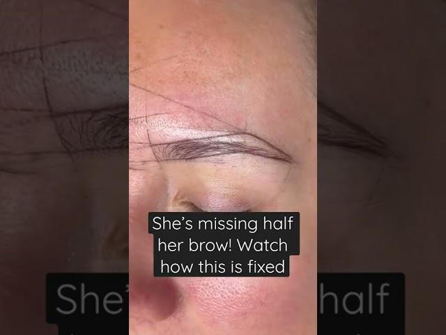 She has a scar and is missing left her brow! Watch how this is fixed with microblading & shading.