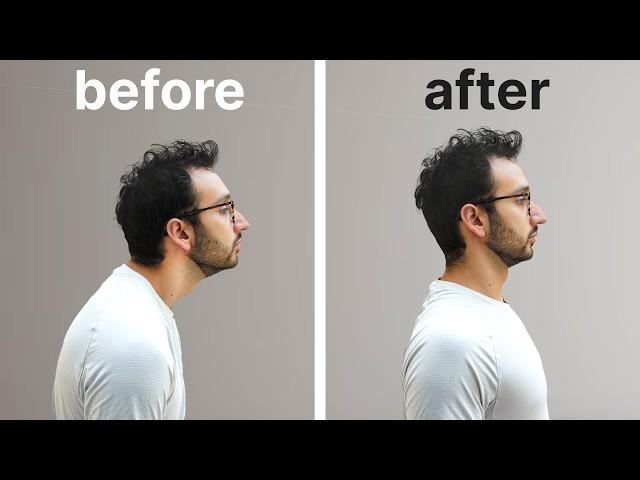 How to Have Perfect Posture (3 Key Exercises)