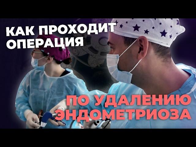 Как лечить эндометриоз | Лечение эндометриоза операция | История пациентки