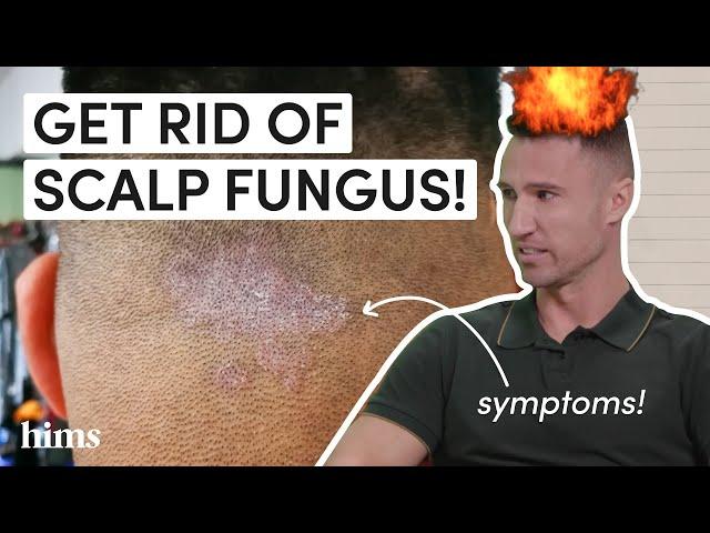 SCALP INFECTION? A Doctor Explains How You Get Scalp Fungus (and How to Treat It)