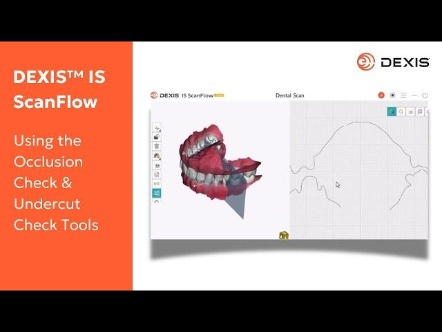 DEXIS™ IS ScanFlow - Using the Occlusion Check & Undercut Check Tools