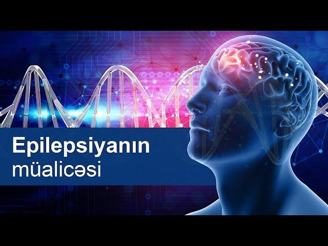 Epilepsiyanın müalicəsi - Nevroloq -Jalə Qarayeva