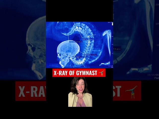 Live Gymnast through X Ray #winela #gymnastics #flexibility #xray #health #talent #didyouknow #skill