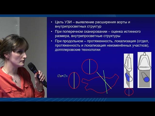 Ультразвуковое исследование в диагностике аневризмы брюшного отдела аорты, Саратова А.К.