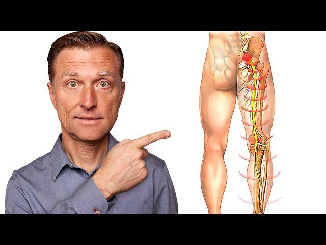 Say Goodbye to Sciatica Nerve Pain in 5 Minutes