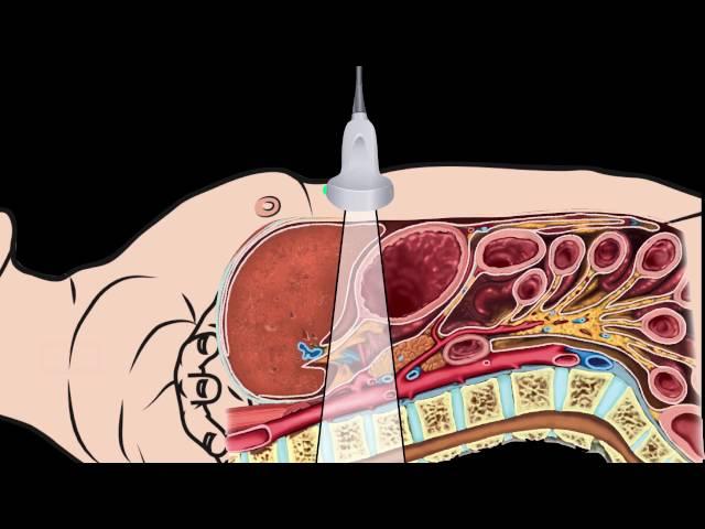 Introduction Abdominal Aorta Focused Ultrasound Examination