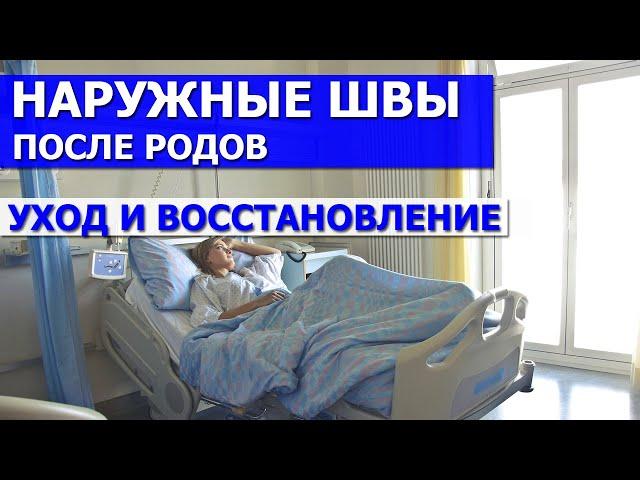 Наружные швы после родов. Уход и восстановление