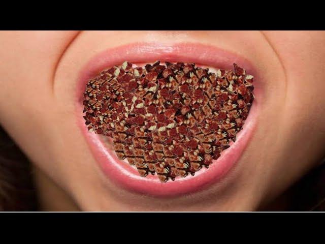 Burett Is Live ASMR Best experience Video maggots remove