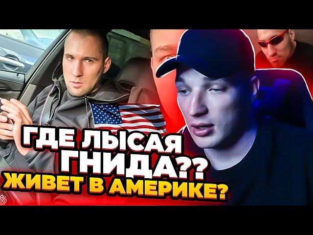 ЭДВАРД БИЛ ПРО ЛЫСУЮ ГНИДУ! КУДА ПРОПАЛ? ЖИВЕТ В АМЕРИКЕ???