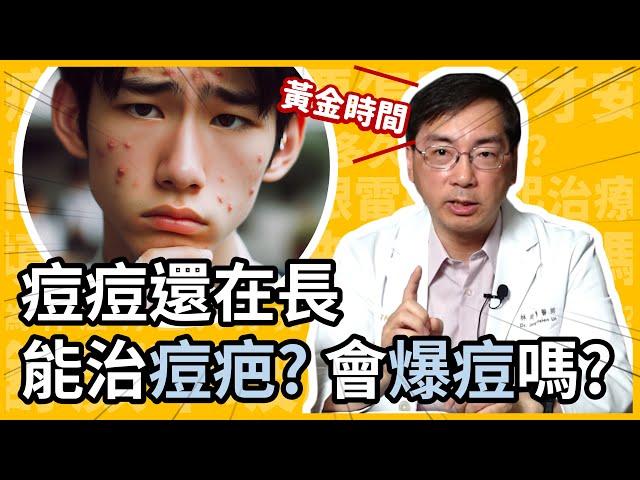 痘疤越早治療越好？痘痘還在長，可以治痘疤？會爆痘嗎？皮膚科林政賢醫師來告訴你把握痘疤治療黃金時間！