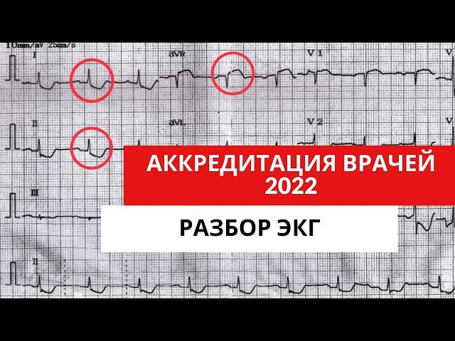 Разбор ЭКГ из АККРЕДИТАЦИИ 2022 года (для кардиологов, терапевтов, функциональных диагностов)Часть 1