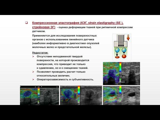 Ультразвуковая диагностика (УЗИ). Доктор Иогансен. Выпуск 3. Режимы ультразвукового сканирования.