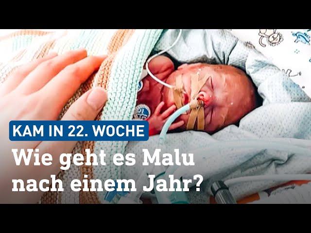 Extrem-Frühchen Malu (22. SSW): So geht es ihm nach einem Jahr | hessenschau