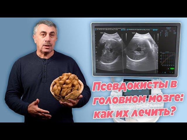 Псевдокисты в головном мозге: как их лечить? - Доктор Комаровский