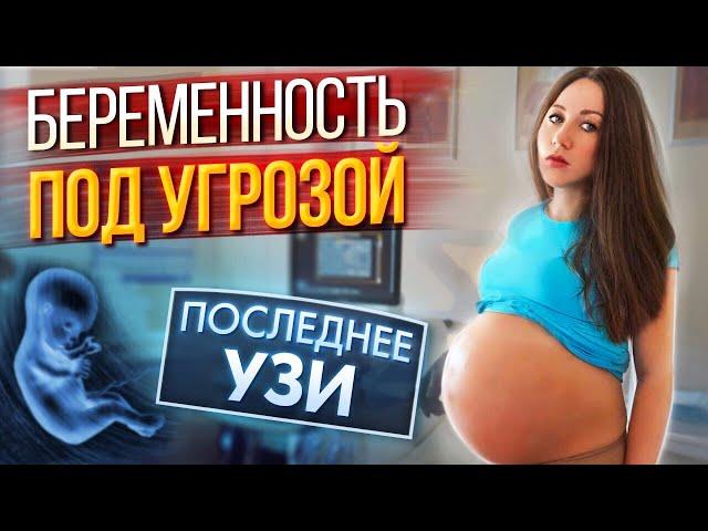 Беременность под Угрозой - Последнее УЗИ  - Я Беременна 37 Недель | Elli Di