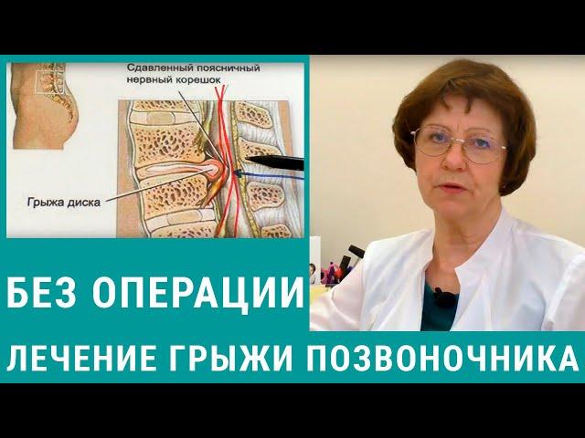 Лечение грыжи позвоночника без операции - как это делается