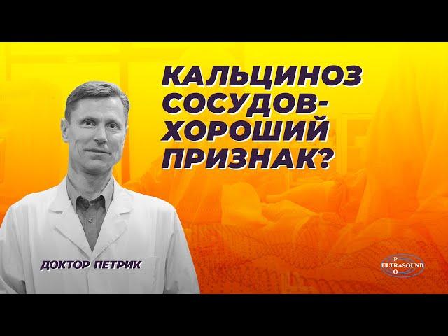 Кальциноз сосудов - хороший признак?