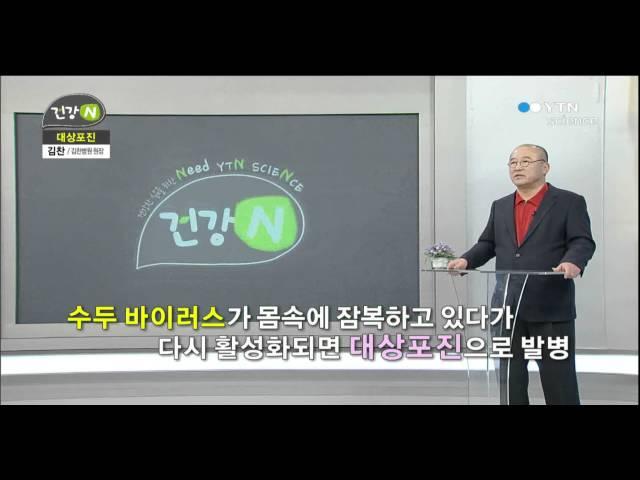 통증의 왕, 대상포진 / YTN 사이언스