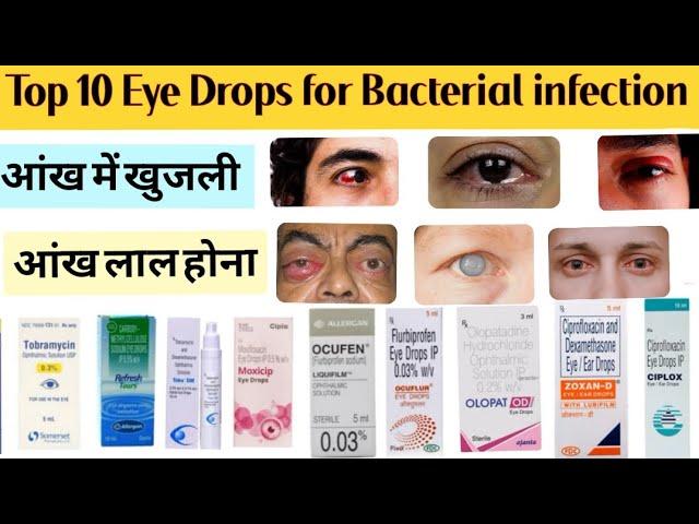 Top 10 Eye Drops for Bacterial Injection | Eye Drops| Top 10 Eye Drops | Eyes Infection| Eye Disease