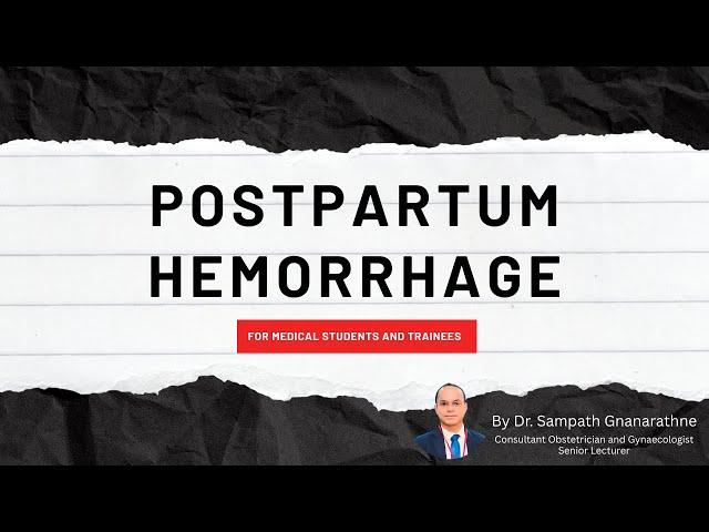Postpartum Hemorrhage Explained | Management & Prevention by Dr. Sampath Gnanarathne