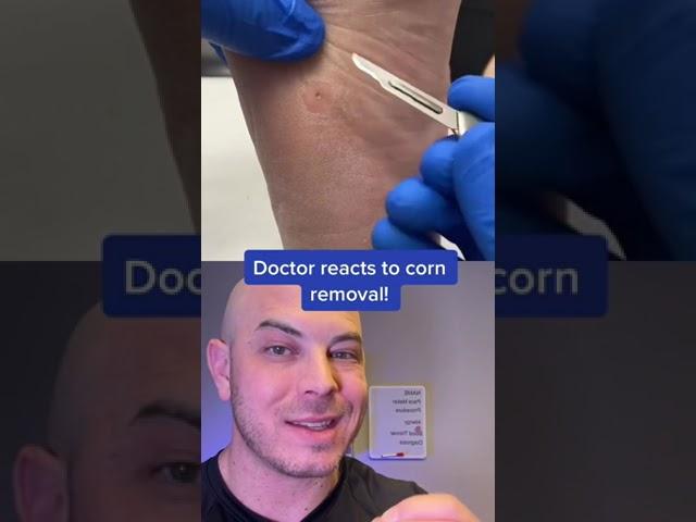 Doctor reacts to corn removal on the foot! #corn #itscorn #dermreacts