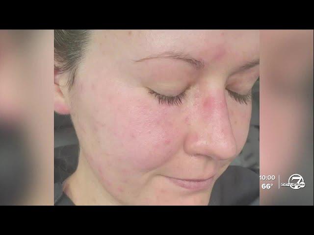 Woman still recovering after rare, extreme complications from West Nile virus