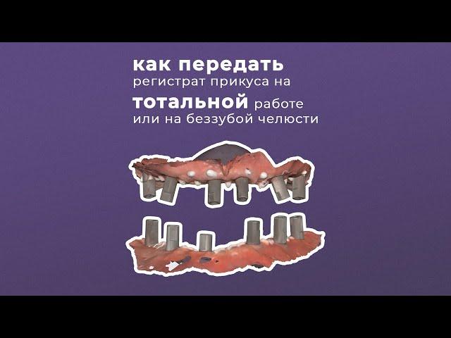 КАК ПЕРЕДАТЬ РЕГИСТРАТ ПРИКУСА НА ТОТАЛЬНОЙ РАБОТЕ ИЛИ НА БЕЗЗУБОЙ ЧЕЛЮСТИ | ARTICON