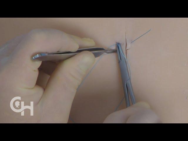 Suture Basics: Vertical Mattress