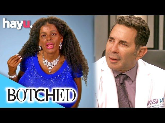 German Lady Wants A Nose Job To Look More 'African' | Botched