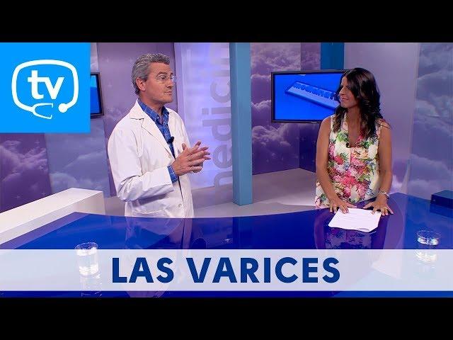 MedicinaTV - 25. Las varices