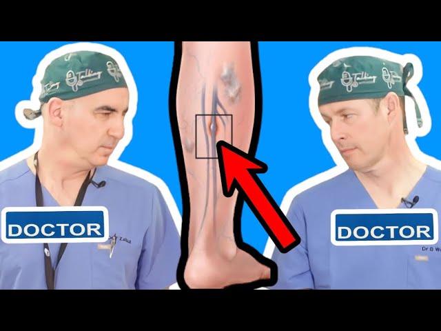 Do I Have a Blood Clot or DVT? Signs & Symptoms