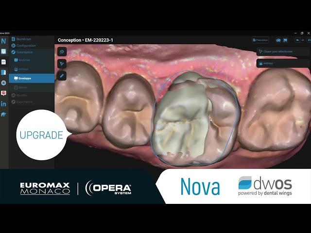  UPGRADE Nova   DWOS by Dental Wings