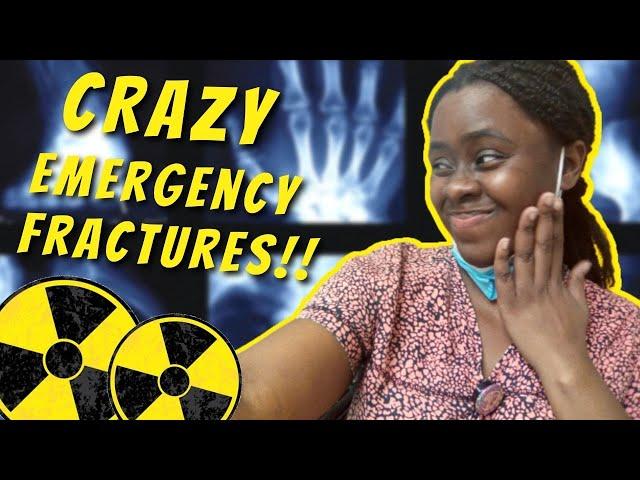 these are some interesting, CRAZY emergency x-rays !!  || Ask The Rad Tech