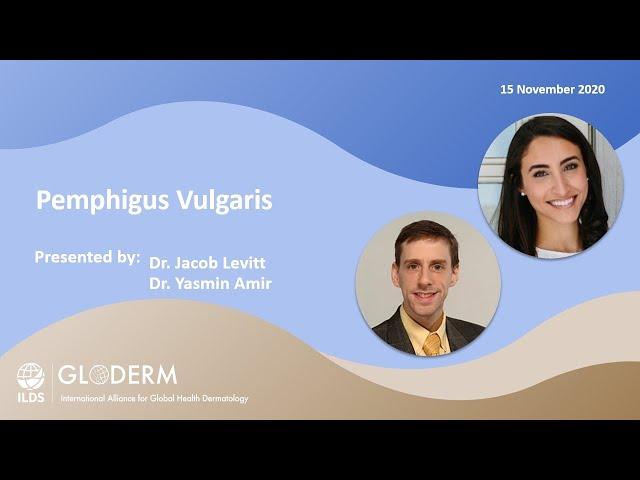 GTC Webinar Series 2020-2021 | Pemphigus Vulgaris