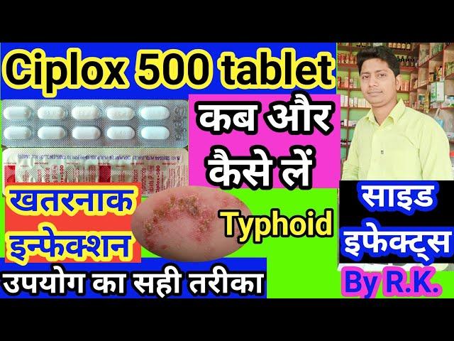 ciplox 500 tablet ke fayde | ciplox 500 tablet uses in hindi |uses of ciplox 500 tablet | Ciplox 500