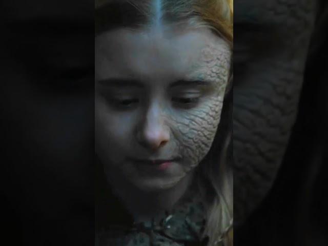 A very beautiful girl and she has a disease #gameofthrones #beautifulgirl  #hdclips