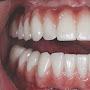 @gnawingteeth3688