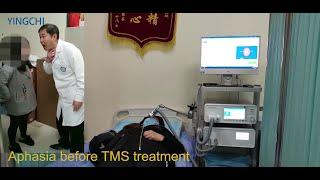 TMS Expert Says: Belief in TMS after 150,000 Treatments -- China West Hospital