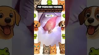 Wow! #pimple #pimplepopping #pimples #shortsfeed #shortvideo #shorts #short #youtubeshorts #youtube