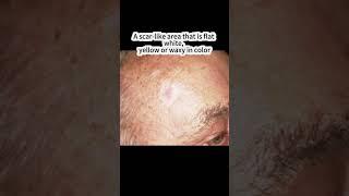 What Does Skin Cancer Look Like? Basal Cell Carcinoma