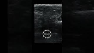 Inguinal hernia in a dog