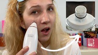 Microdermabrasion Device For AT HOME?! Vanity Planet Exfora